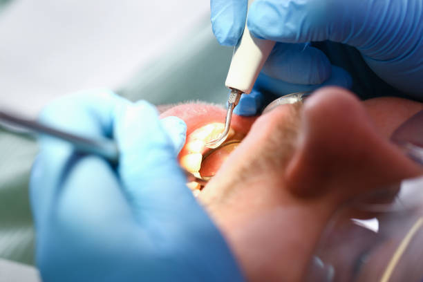 Best Emergency Dental Care for Broken or Chipped Teeth in Lebanon, NH