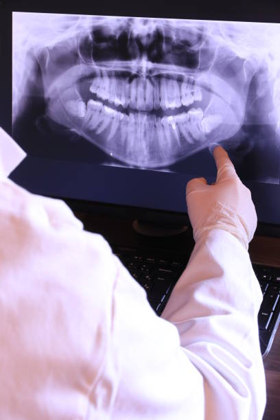 Best Emergency Denture Repair in Lebanon, NH